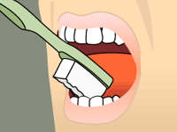 brushing diagram